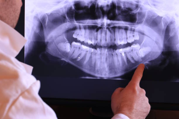 Best Broken Tooth Emergency  in Kimberly, ID