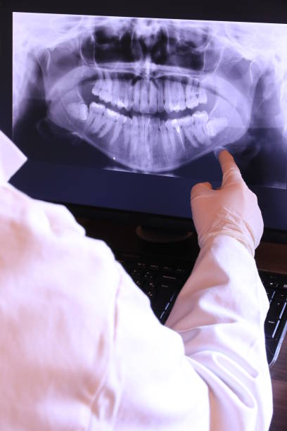 Best Chipped Tooth Repair Near Me  in Kimberly, ID