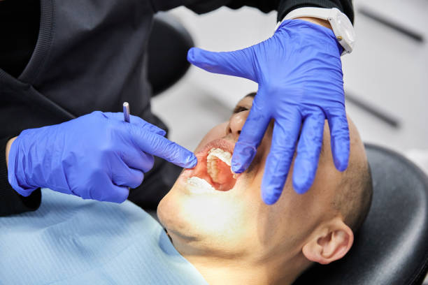 Best Dentist for Tooth Abscess  in Kimberly, ID